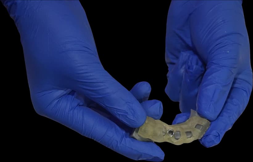 Printed surgical guide component inspected in gloved hands.