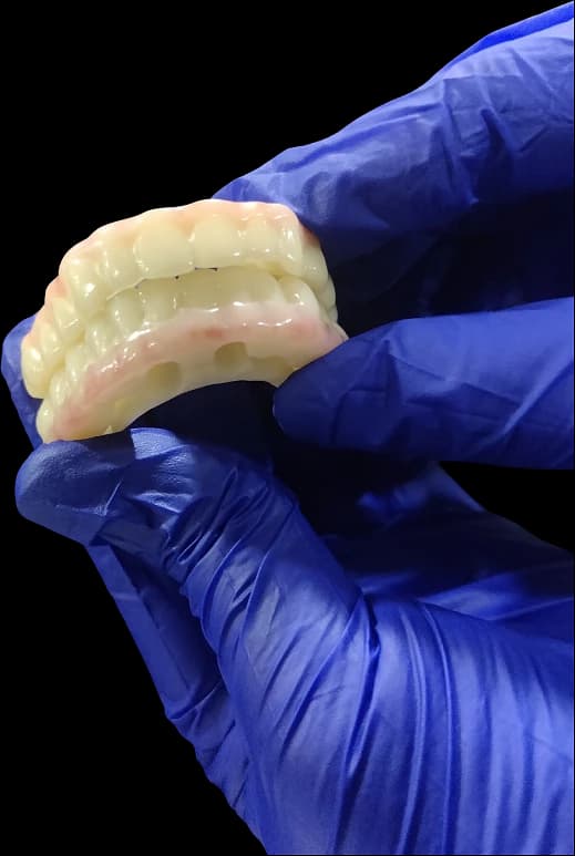 Printed temporary full-arch prosthesis held in a gloved hand.