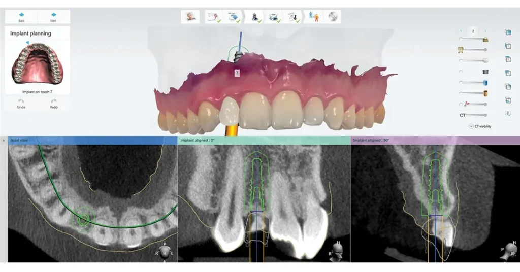 3D Printing The Future of Precision Dentistry