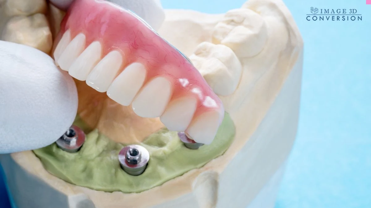 Guided Dental Implants A Hands-On Workshop