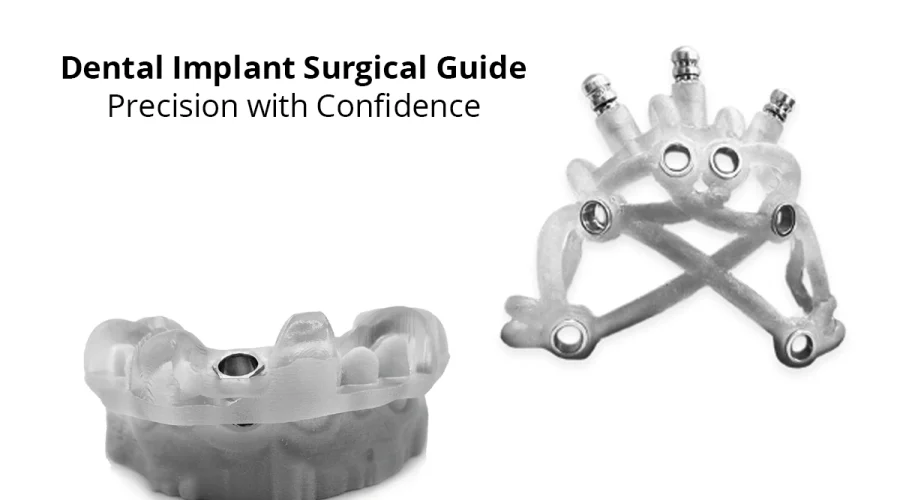dental-implant-blog-post